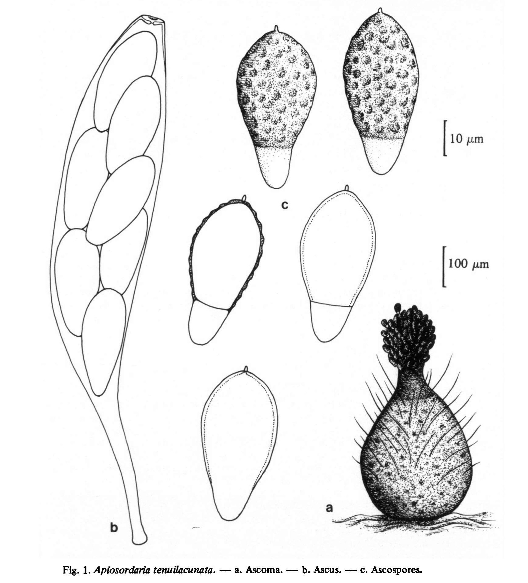 Ascoma, ascus and ascospores of Apiosordaria tenuilacunata