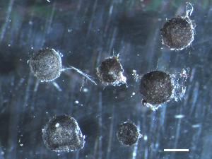 Figure 2: Sclerotia of Cenococcum geophilum (Scale bar = 1mm). Photo credit: Martina Peter (WSL).