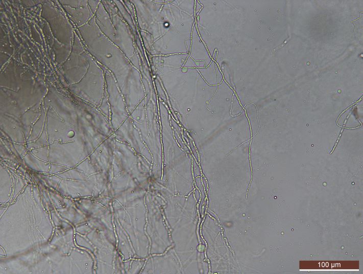 Mycelium of Linnemannia elongata OR4_A40 under 20x magnification. Image by Kyle Mondron.
